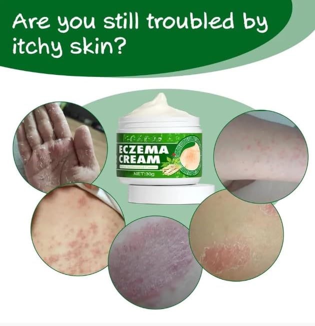 Antibacterial Moisturizing Cream for Dry, Itchy, and Sensitive Skin (pack of 2)