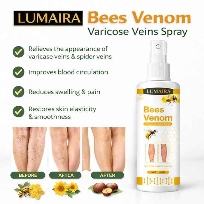 Bee Venon Varicose Veins Spray (Pack of 2)