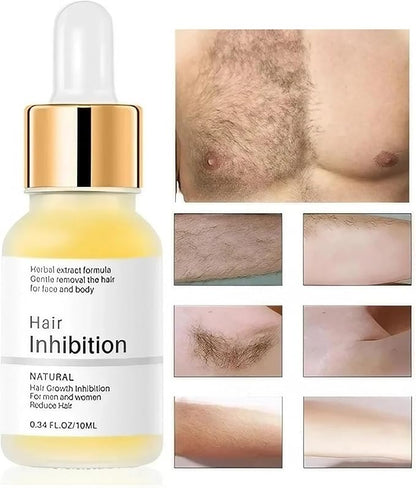 15277